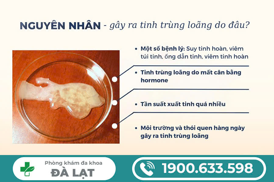 Hình ảnh minh họa